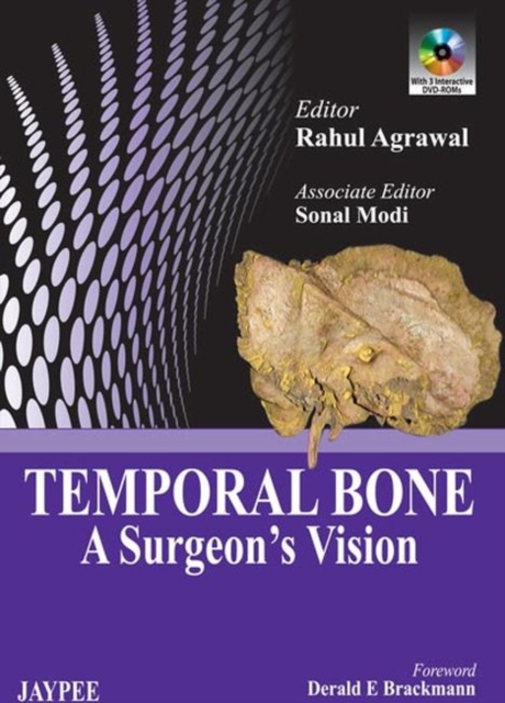 Temporal Bone : A Surgeon's Vision, Hardback Book