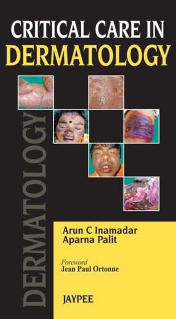 Critical Care in Dermatology, Paperback / softback Book