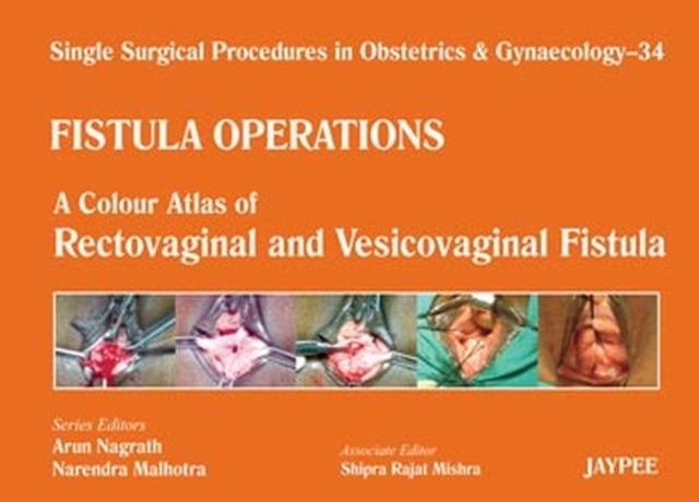 Single Surgical Procedures in Obstetrics and Gynaecology - 34 - Fistula Operations: A Colour Atlas of Rectovaginal and Vesicovaginal Fistula, Hardback Book