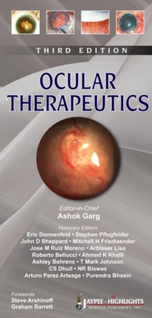 Ocular Therapeutics, Paperback / softback Book