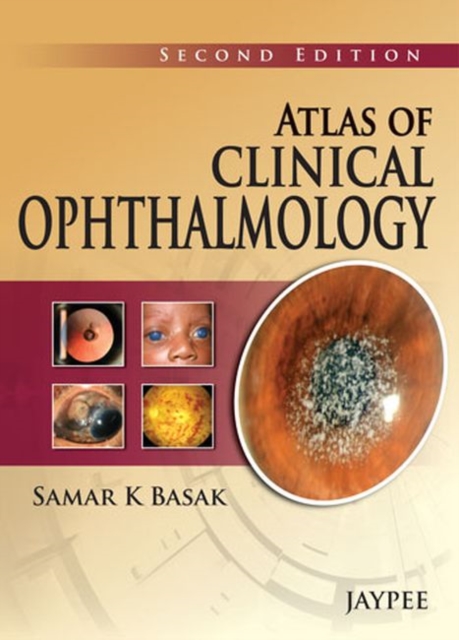 Atlas of Clinical Ophthalmology, Hardback Book