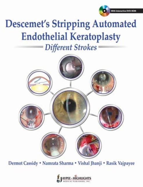 Descemet's Stripping Automated Endothelial Keratoplasty: Different Strokes, Hardback Book
