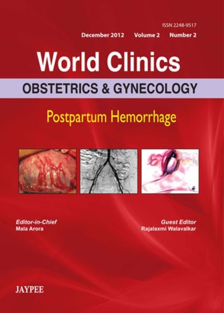 World Clinics: Obstetrics & Gynecology: Postpartum Hemorrhage, Hardback Book