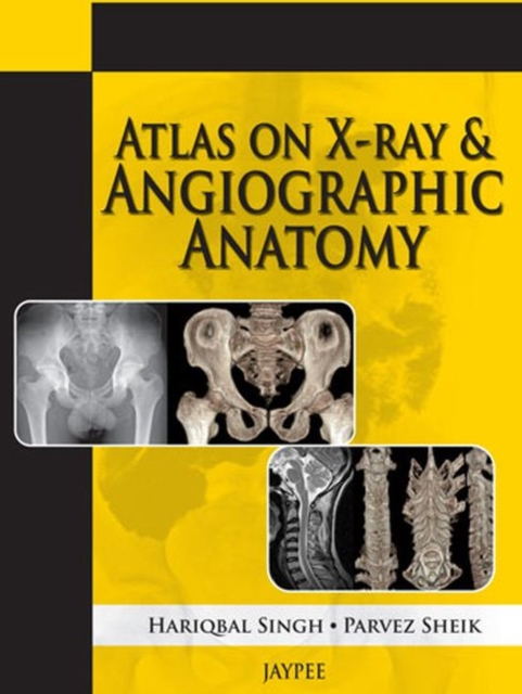 Atlas on X-Ray and Angiographic Anatomy, Paperback / softback Book