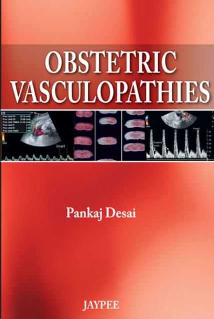 Obstetric Vasculopathies, Paperback / softback Book