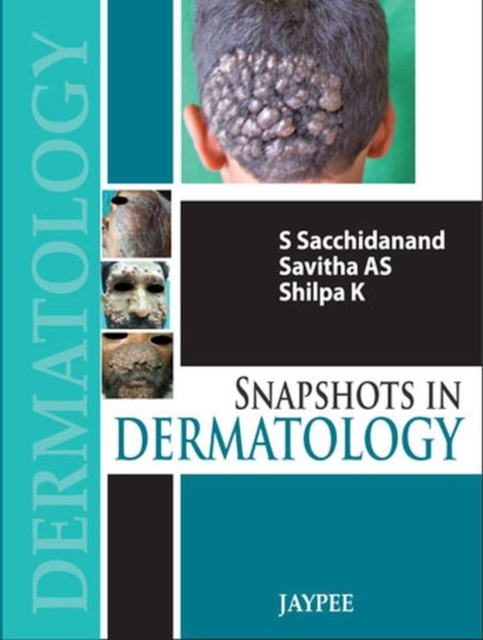 Snapshots in Dermatology, Paperback / softback Book