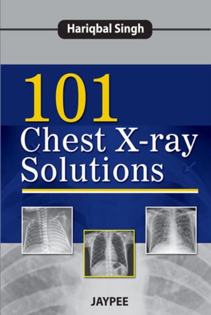 101 Chest X-Ray Solutions, Paperback / softback Book