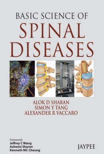 Basic Science of Spinal Diseases, Hardback Book