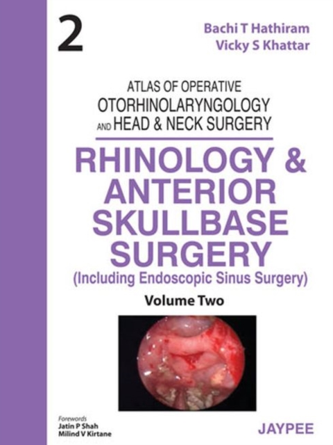 Atlas of Operative Otorhinolaryngology and Head & Neck Surgery: Rhinology and Anterior Skullbase Surgery, Hardback Book