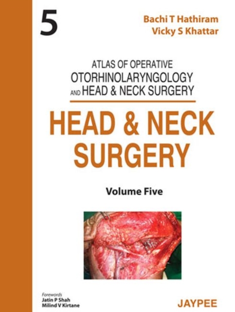 Atlas of Operative Otorhinolaryngology and Head & Neck Surgery: Head and Neck Surgery, Hardback Book