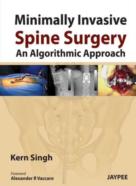 Minimally Invasive Spine Surgery: An Algorithmic Approach, Hardback Book