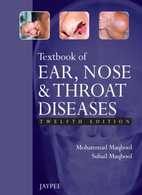 Textbook of Ear, Nose and Throat Diseases, Paperback / softback Book