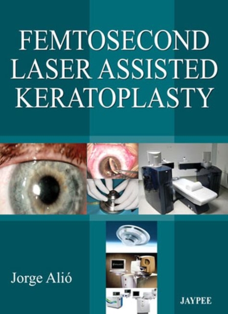 Femtosecond Laser Assisted Keratoplasty, Hardback Book