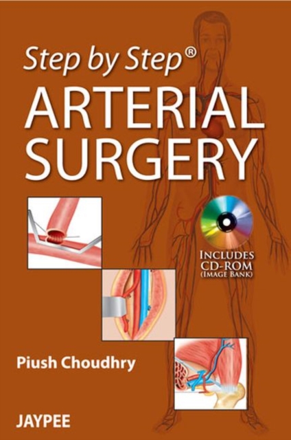 Step by Step: Arterial Surgery, Paperback / softback Book