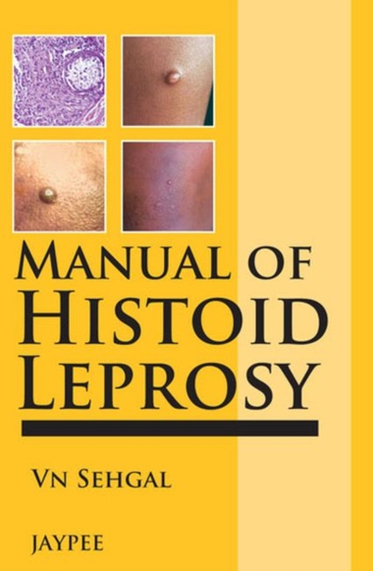 Manual of Histoid Leprosy, Paperback / softback Book