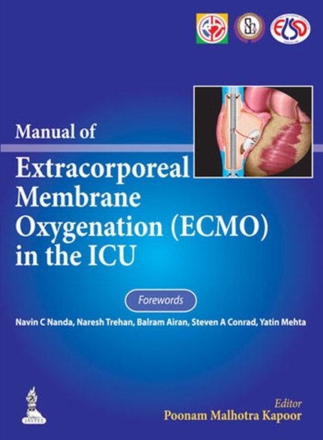 Manual of Extracorporeal Membrane Oxygenation (ECMO) in the ICU, Hardback Book