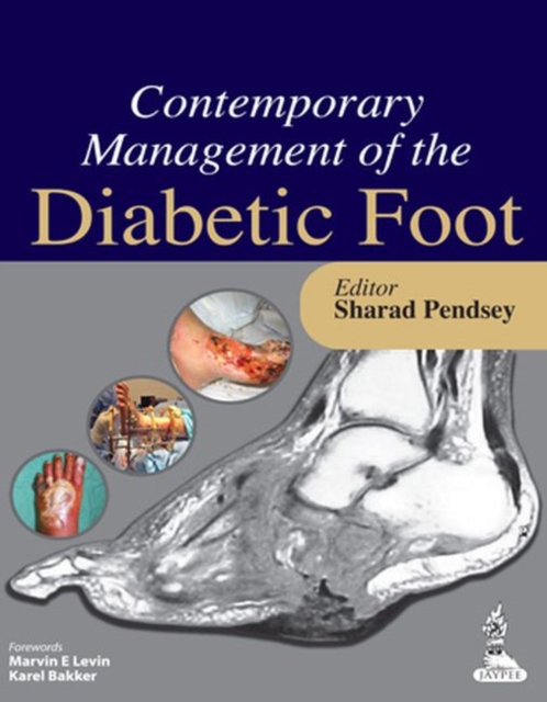 Contemporary Management of the Diabetic Foot, Paperback / softback Book