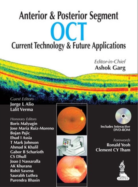 Anterior & Posterior Segment OCT: Current Technology & Future Applications, Paperback / softback Book