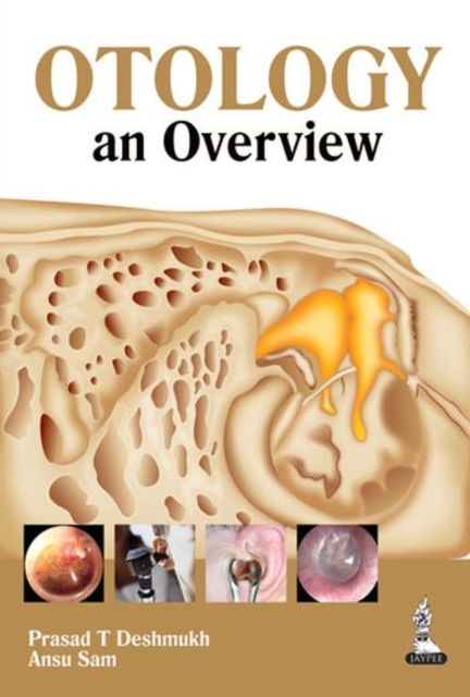 Otology: an Overview, Paperback / softback Book