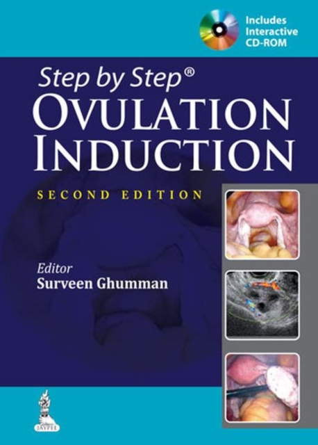 Ovulation Induction, Paperback / softback Book
