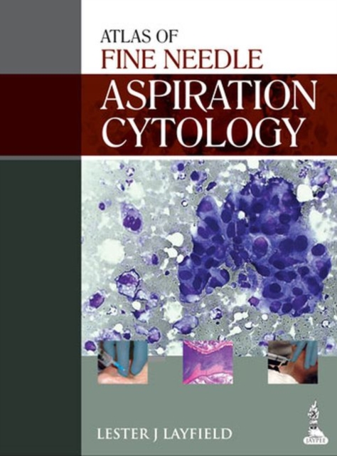 Atlas of Fine Needle Aspiration Cytology, Hardback Book