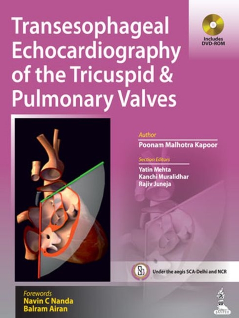 Transesophageal Echocardiography of the Tricuspid & Pulmonary Valves, Hardback Book