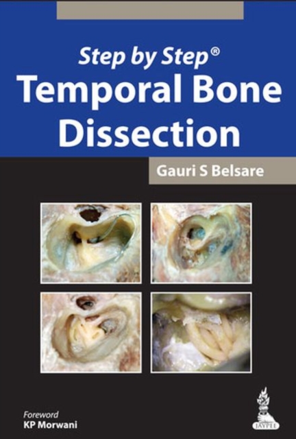 Step by Step: Temporal Bone Dissection, Paperback / softback Book