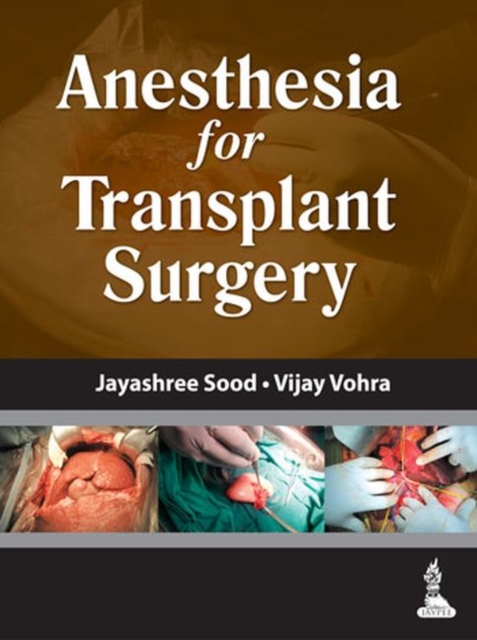 Anesthesia for Transplant Surgery, Hardback Book