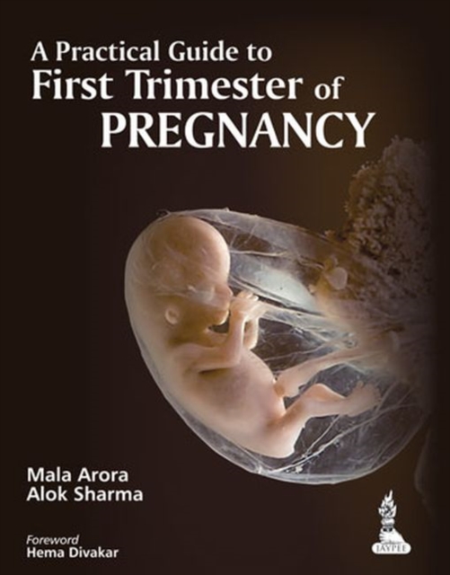 A Practical Guide to First Trimester of Pregnancy, Paperback / softback Book