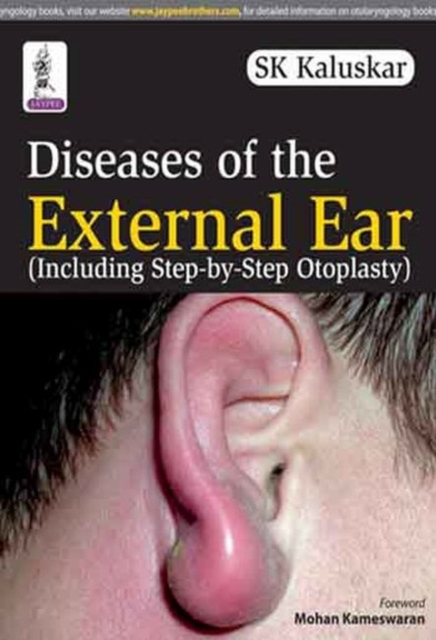 Diseases of the External Ear, Paperback / softback Book