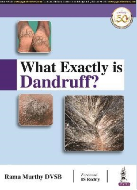 What Exactly is Dandruff?, Paperback / softback Book