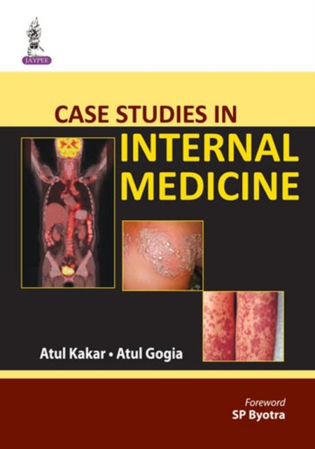 Case Studies in Internal Medicine, Paperback / softback Book