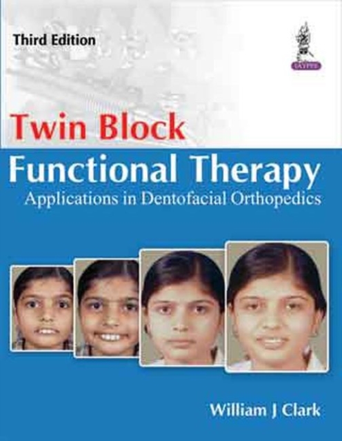 Twin Block Functional Therapy, Hardback Book