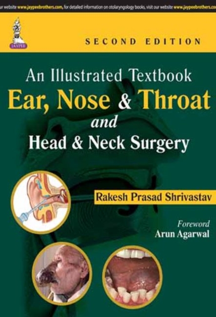An Illustrated Textbook: Ear, Nose & Throat and Head & Neck Surgery, Paperback / softback Book