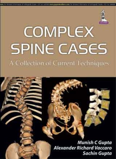 Complex Spine Cases: A Collection of Current Techniques, Hardback Book
