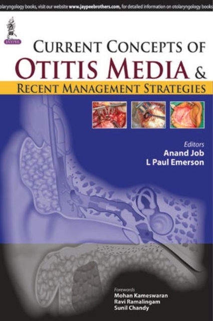 Current Concepts of Otitis Media and Recent Management Strategies, Paperback / softback Book