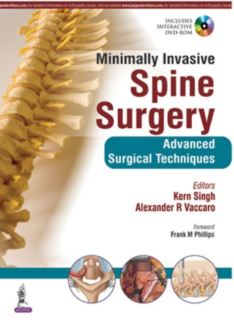Minimally Invasive Spine Surgery, Hardback Book