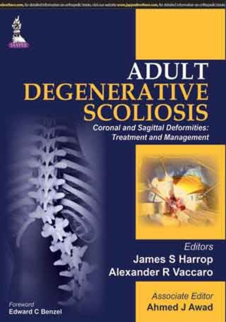 Adult Degenerative Scoliosis, Hardback Book