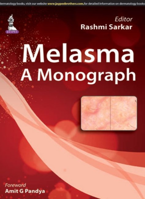 Melasma: A Monograph, Paperback / softback Book