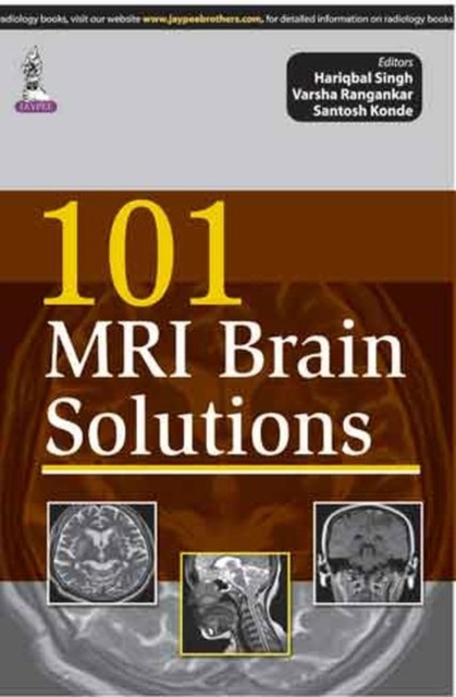 101 MRI Brain Solutions, Paperback / softback Book