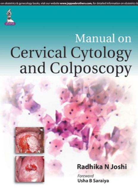Manual on Cervical Cytology and Colposcopy, Paperback / softback Book