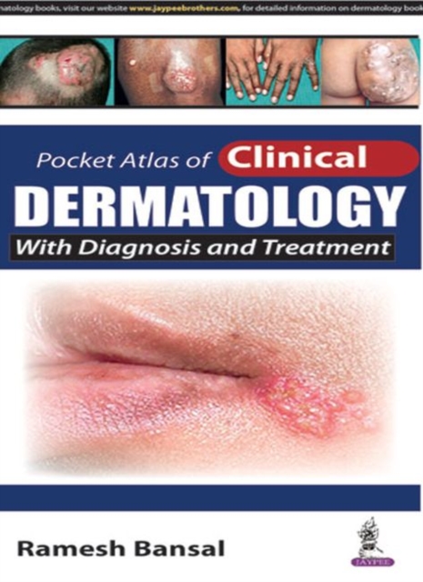 Pocket Atlas of Clinical Dermatology, Paperback / softback Book
