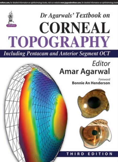 Dr Agarwal's Textbook on Corneal Topography, Hardback Book