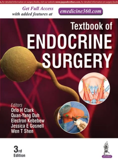Textbook of Endocrine Surgery, Hardback Book