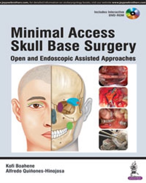 Minimal Access Skull Base Surgery : Open and Endoscopic Assisted Approaches, Hardback Book