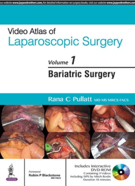 Video Atlas of Laparoscopic Surgery : Volume 1: Bariatric Surgery, Multiple-component retail product Book
