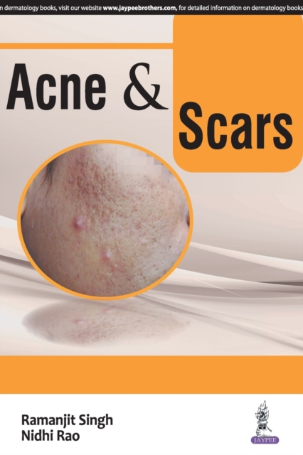 Acne & Scars, Paperback / softback Book