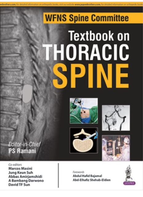 WFNS Spine Committee Textbook on Thoracic Spine, Hardback Book
