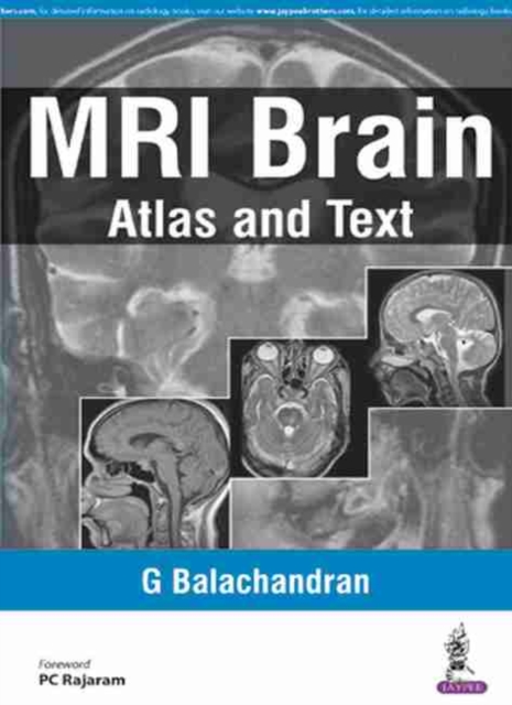 MRI Brain : Atlas and Text, Paperback / softback Book