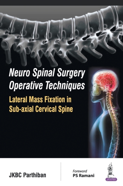 Neuro Spinal Surgery Operative Techniques: Lateral Mass Fixation in Sub-axial Cervical Spine, Paperback / softback Book